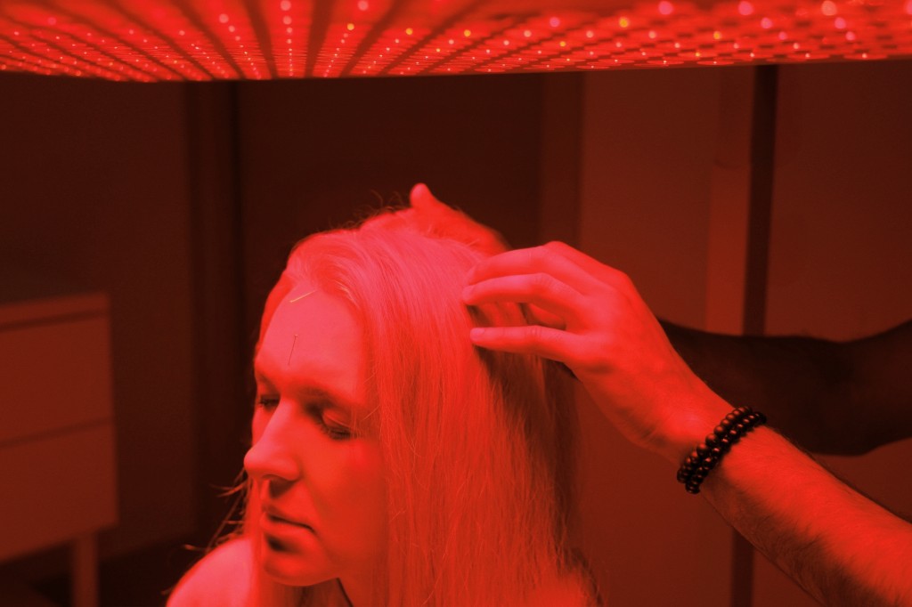 Red light panels used during acupuncture treatment